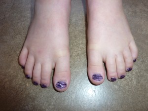 purple, silver gel toes with black zebra stripes